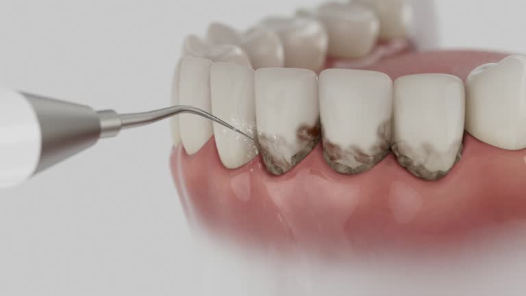 Trusted Root Canal Treatment service in Atascadero, CA - Dentist Open Now
